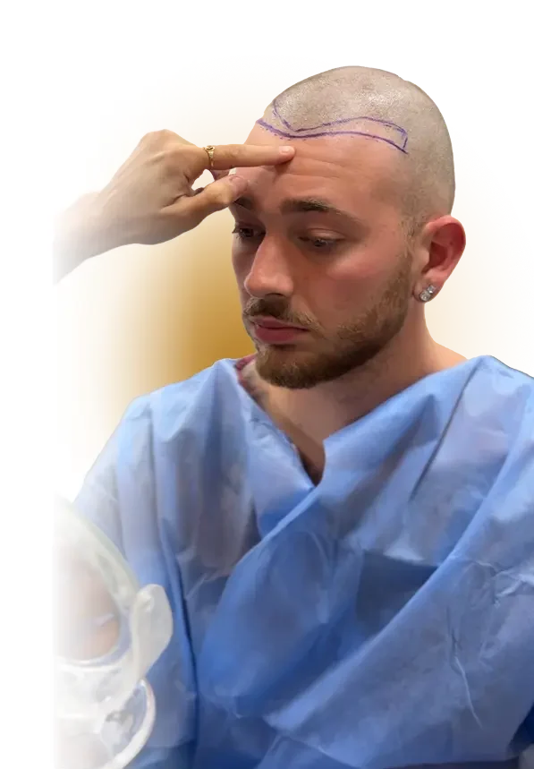 Rinoplastica Tecniche